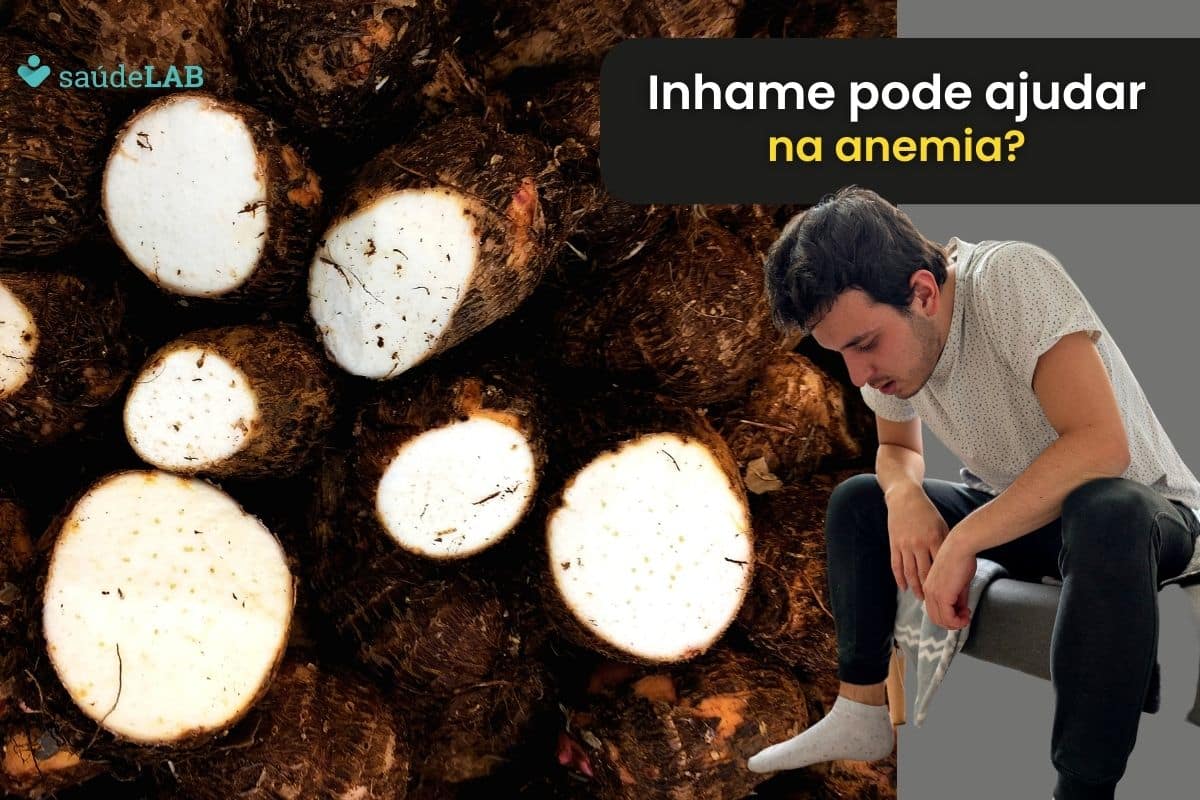 Inhame é bom para anemia? Descubra se vale a pena investir nele 1 Inhame é bom para anemia.