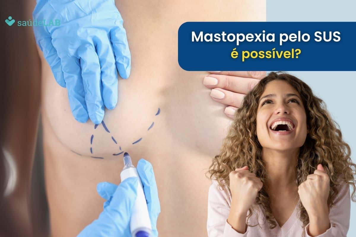 Mastopexia pelo SUS.