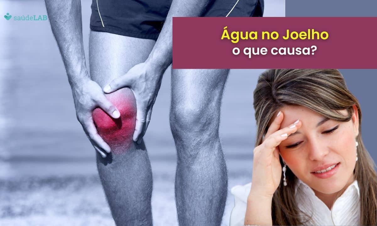 O que causa água no joelho? Conheça as causas, consequências e tratamentos 1 O que causa água no joelho.