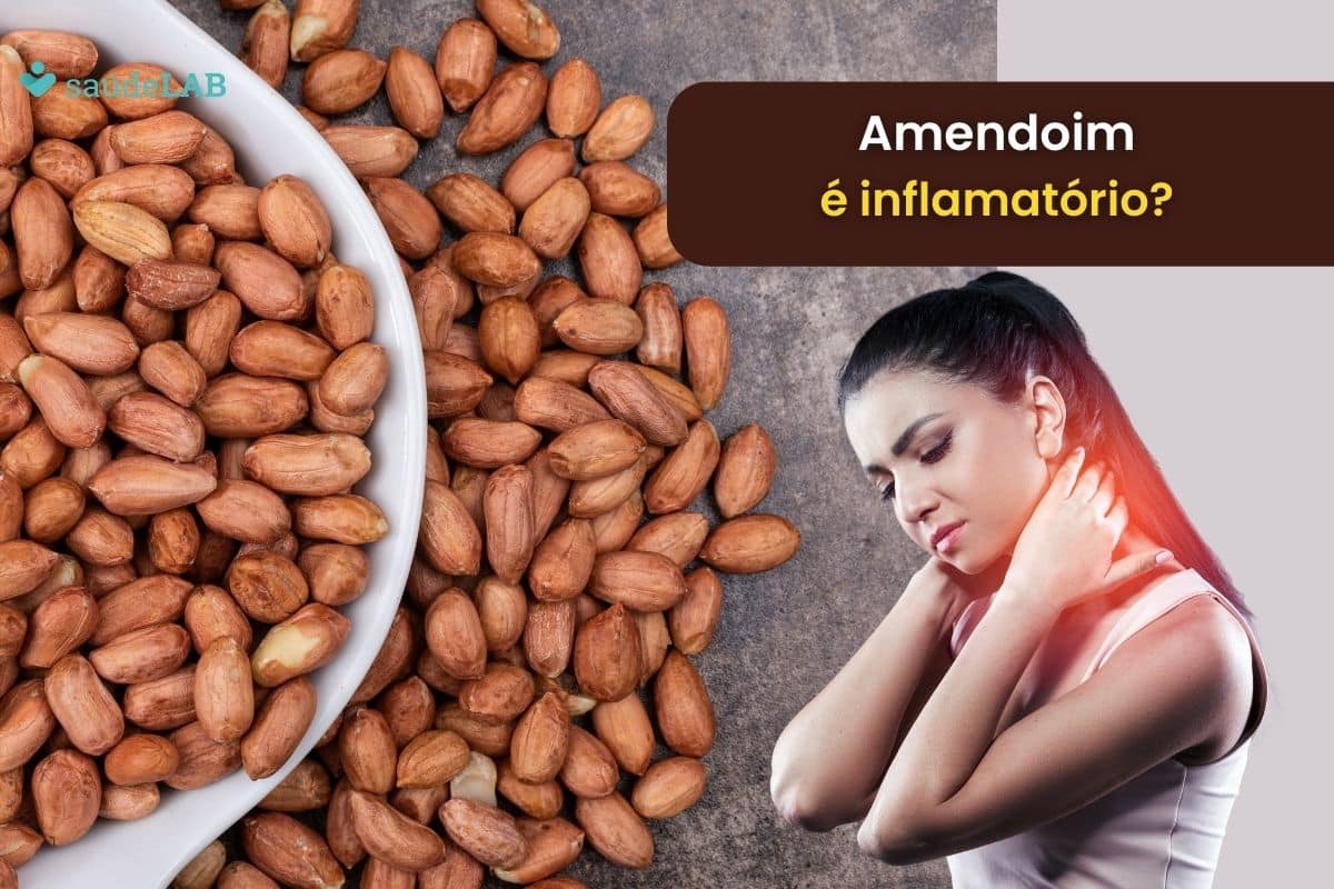 Amendoim é inflamatório? Entenda melhor em quais ocasiões ele deve ser evitado 1 Amendoim é inflamatório.