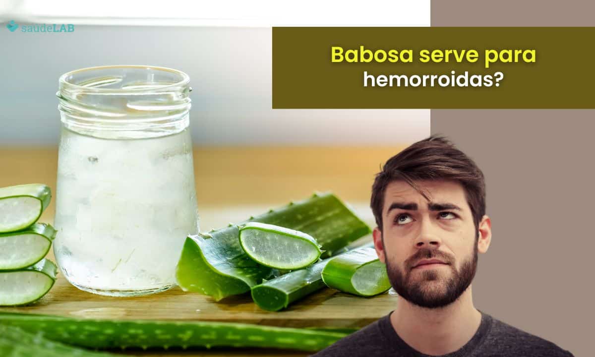 Babosa é bom para hemorroida? Saiba os cuidados ao usar a planta 1 Babosa é boa para hemorroida.