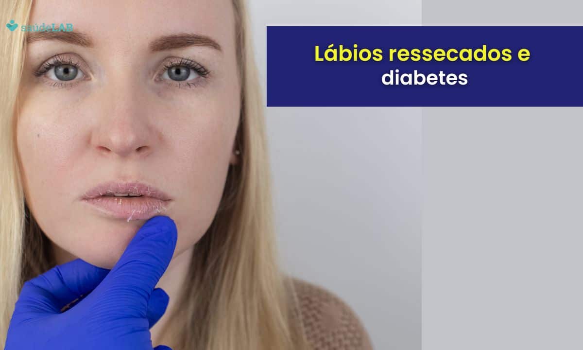 Lábios ressecados e diabetes: entenda como aliviar o sintoma 1 Lábios ressecados e diabetes.