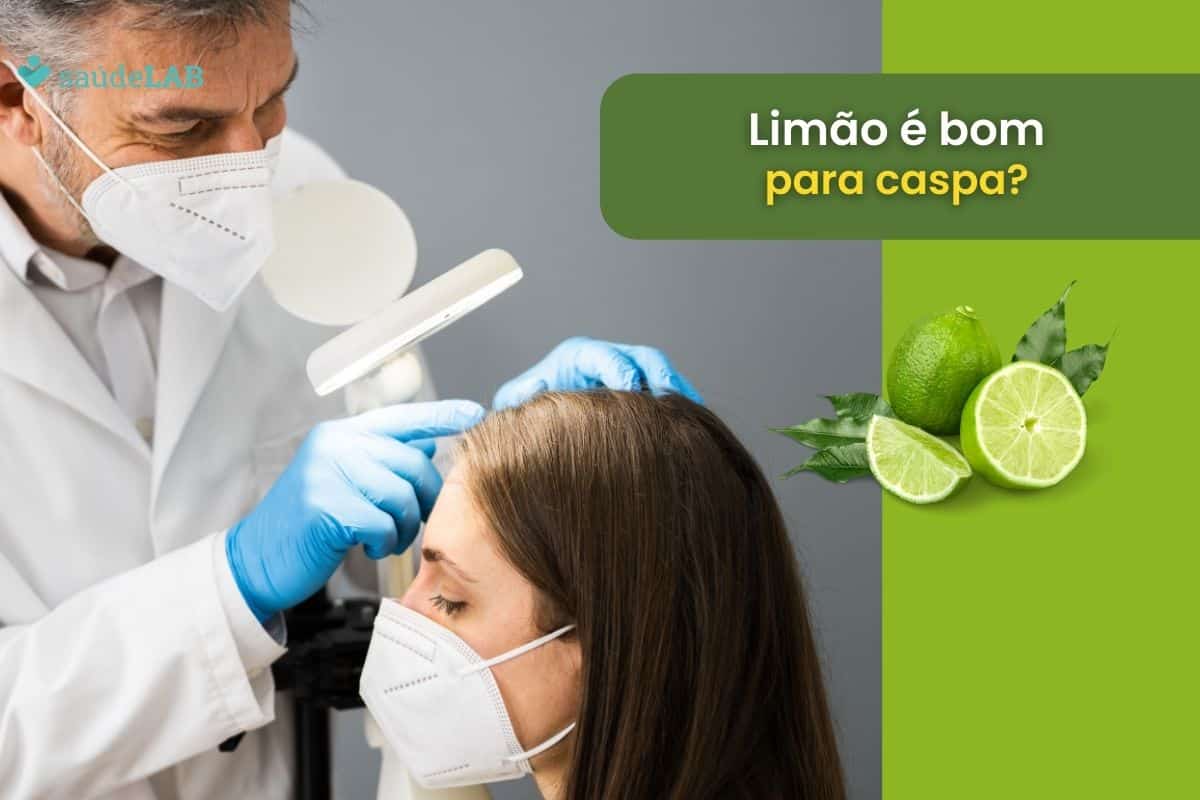 Limão é bom para caspa, ou isso é apenas um mito? Desvende o mistério agora 1 Limão é bom para caspa.