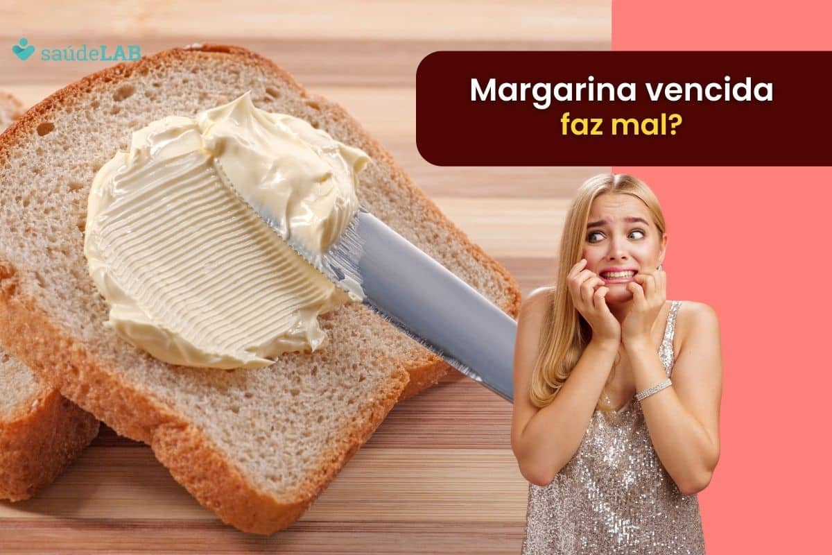 Margarina vencida faz mal? Entenda se é segura após a data de validade 1 margarina vencida faz mal.