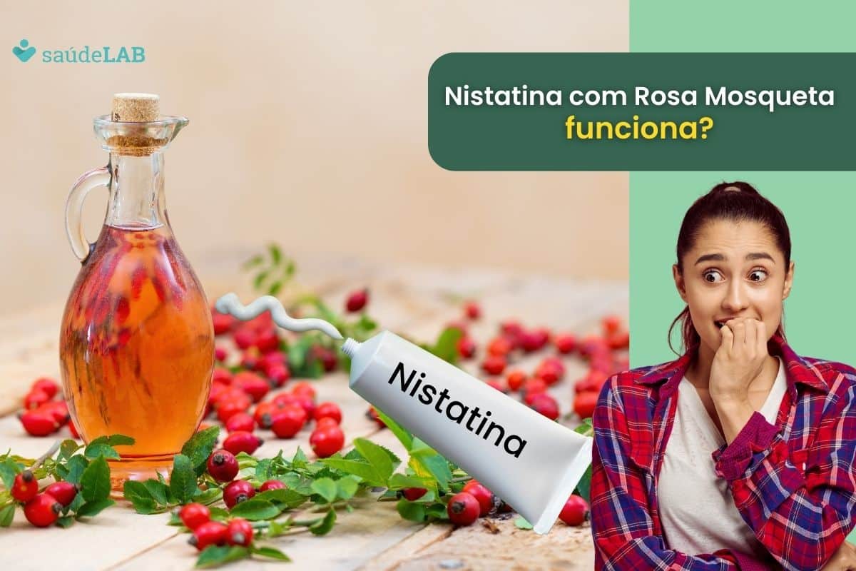 Descubra a eficácia real da Nistatina com Rosa Mosqueta para melasma 1 nistatina com rosa mosqueta para melasma.