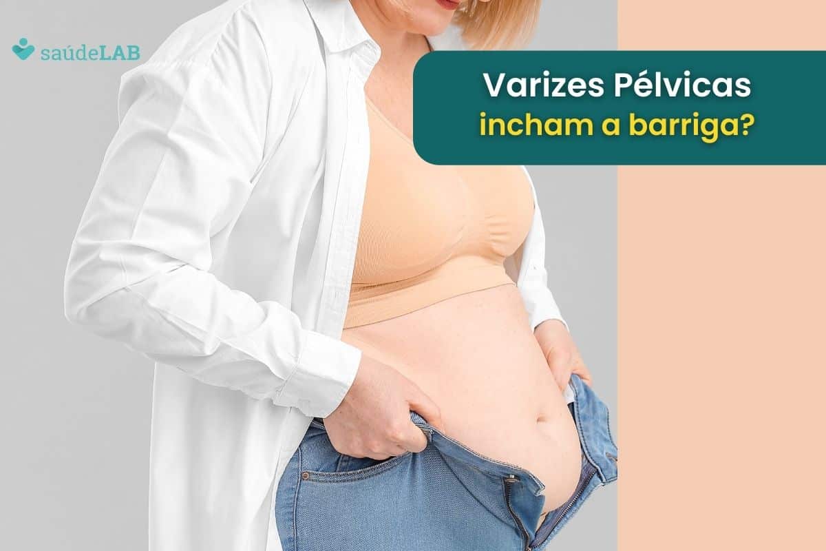 Varizes Pélvicas: será que elas podem causar inchaço na barriga? Saiba tudo aqui 1 varizes pélvicas incham a barriga.