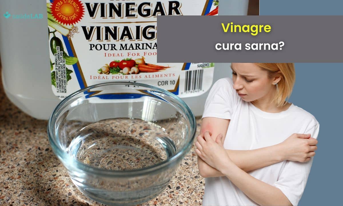 Vinagre é bom para sarna humana? Saiba agora se funciona mesmo! 1 vinagre é bom para sarna humana.
