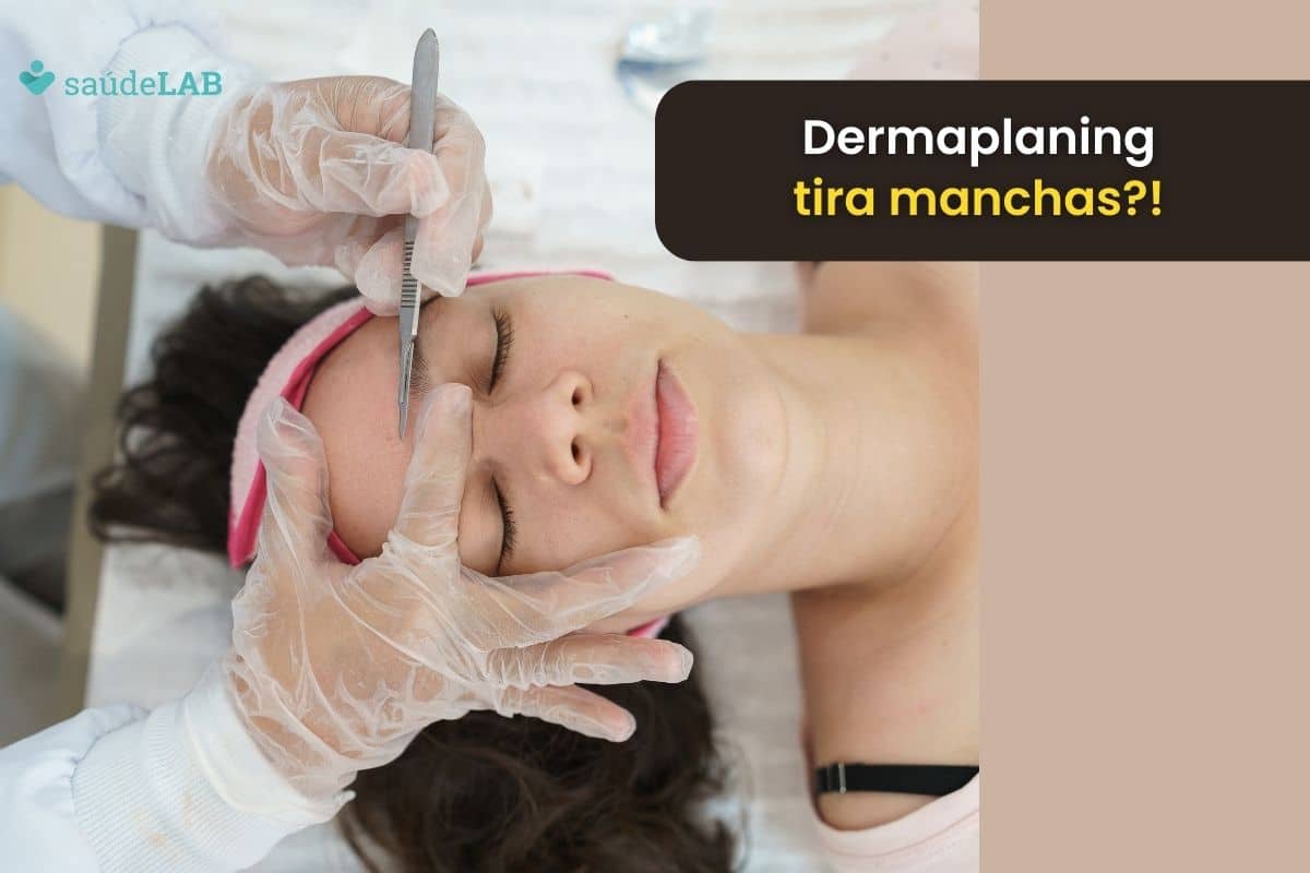 Dermaplaning: saiba tudo sobre a esfoliação feita com bisturi 1 Dermaplaning tira manchas.