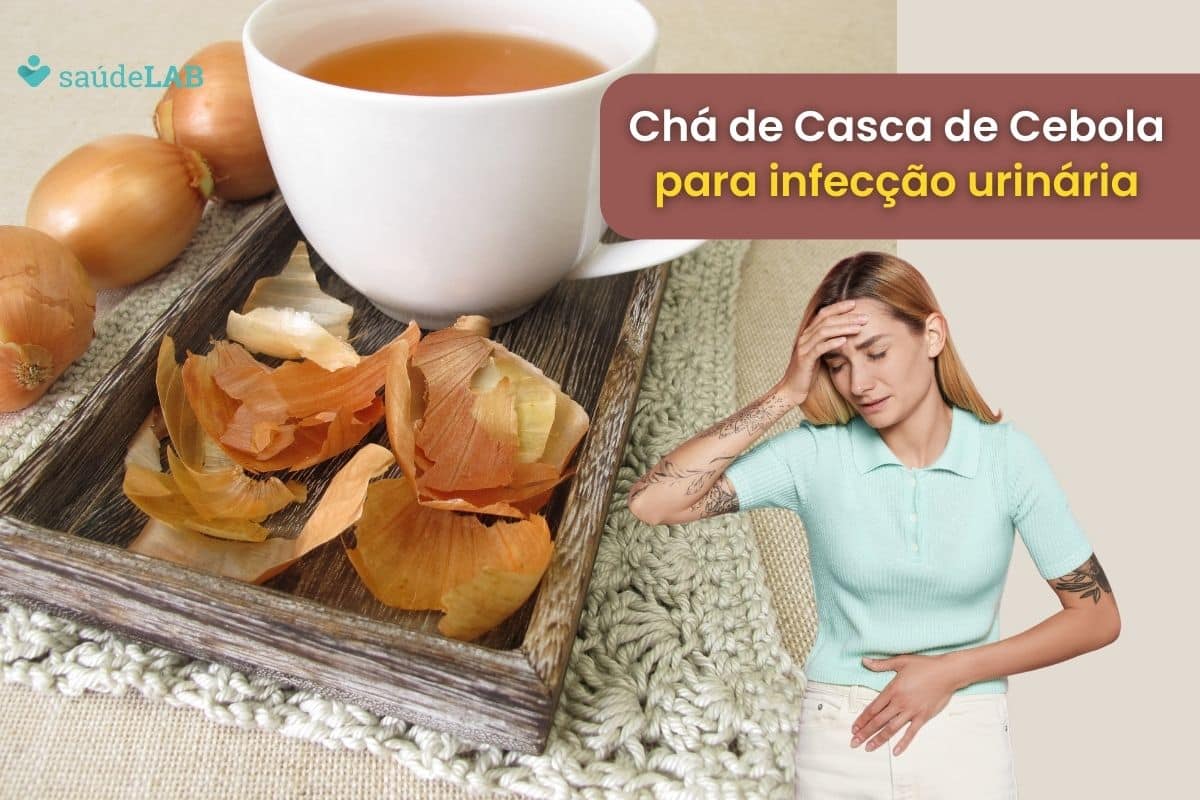 Chá de casca de cebola para infecção urinária será que funciona? Saiba tudo sobre ele 1 Chá de casca de cebola para infecção urinária.