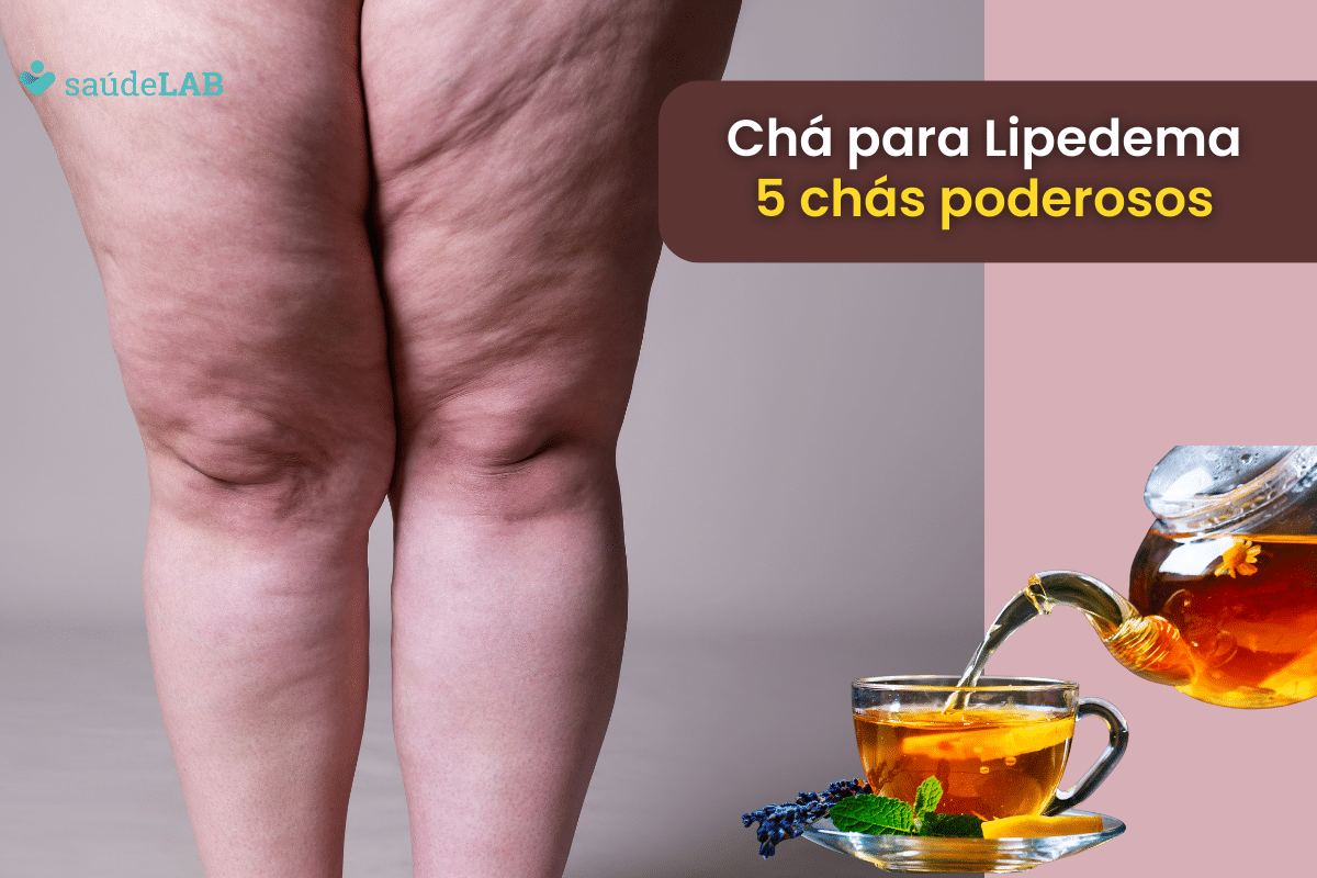 Chá para Lipedema: 5 opções naturais para combater os sintomas 1 chá para lipedema.