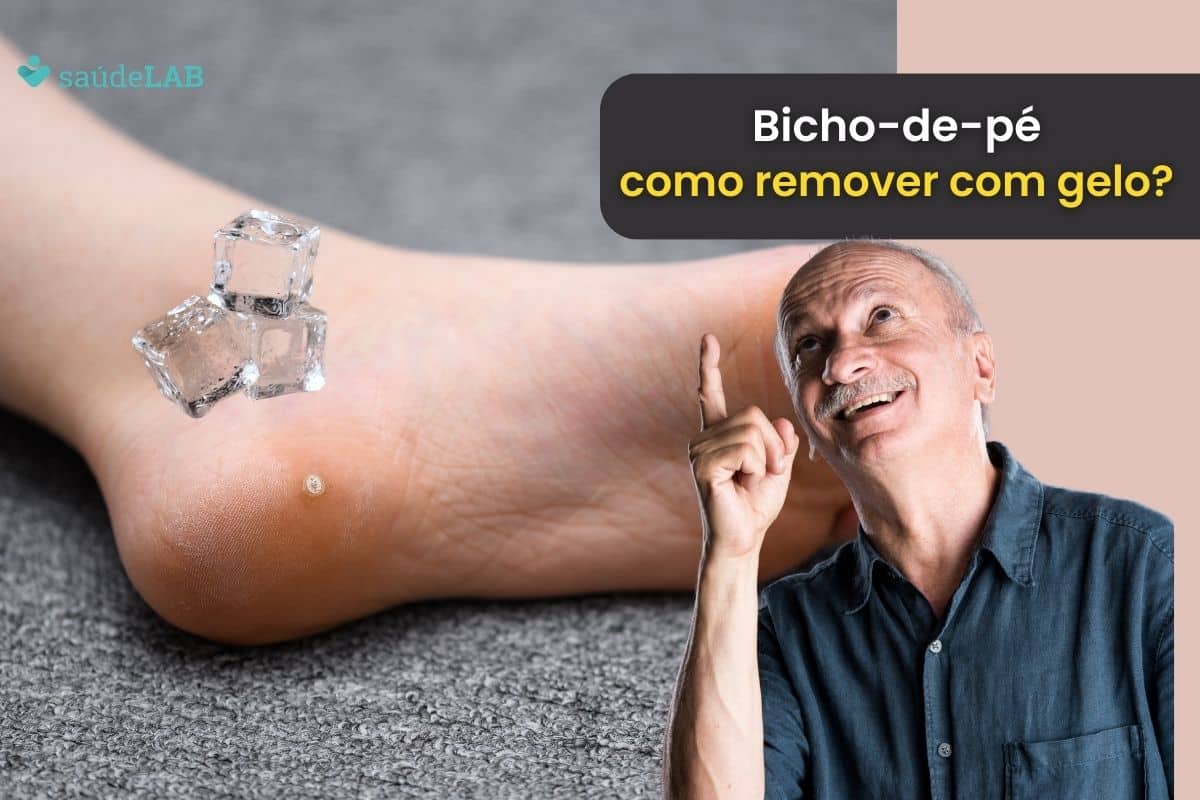 Tem como tirar bicho-de-pé com gelo? Entenda como resolver o problema 1 como tirar bicho-de-pé com gelo.