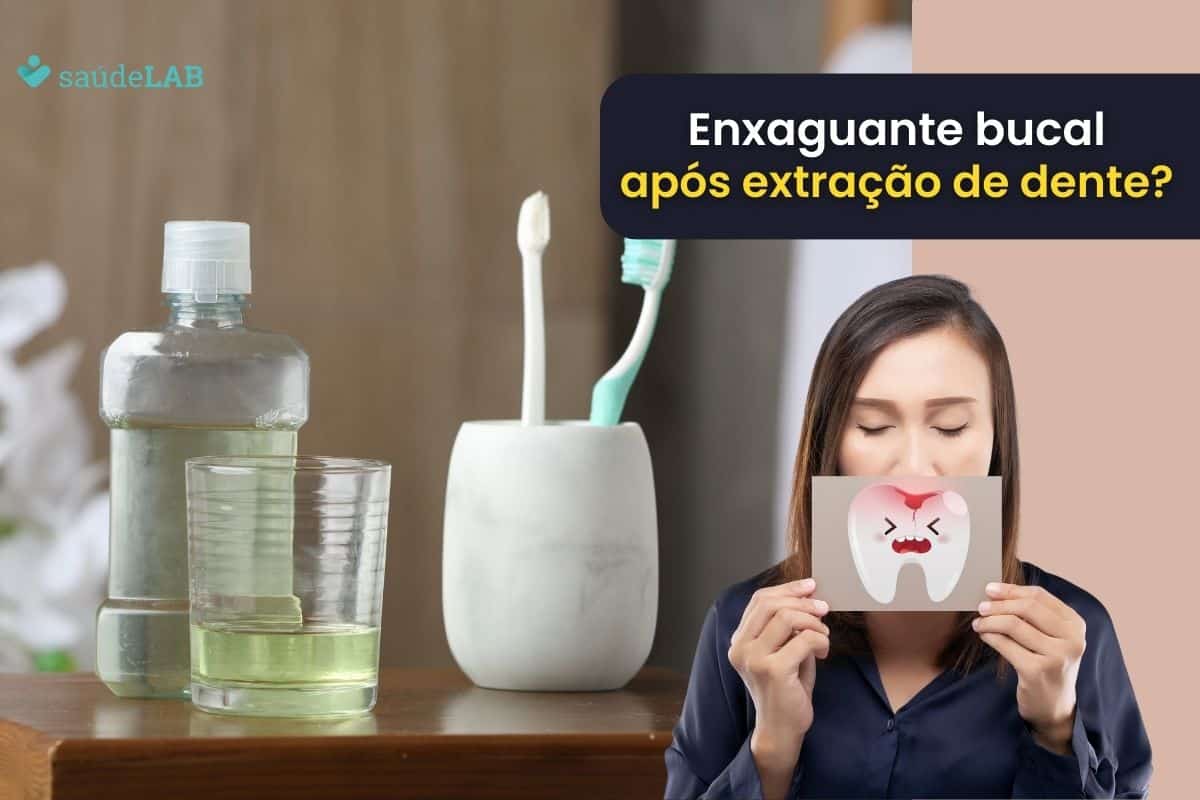 Pode usar enxaguante bucal depois de extrair um dente? Descubra aqui! 1 pode usar enxaguante bucal depois de extrair um dente.