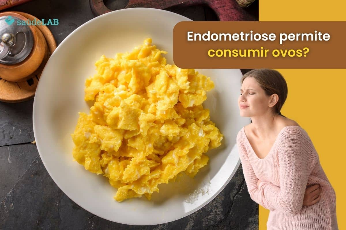 Quem tem endometriose pode comer ovo? Descubra agora se o alimento pode piorar a situação 1 Quem tem endometriose pode comer ovo?