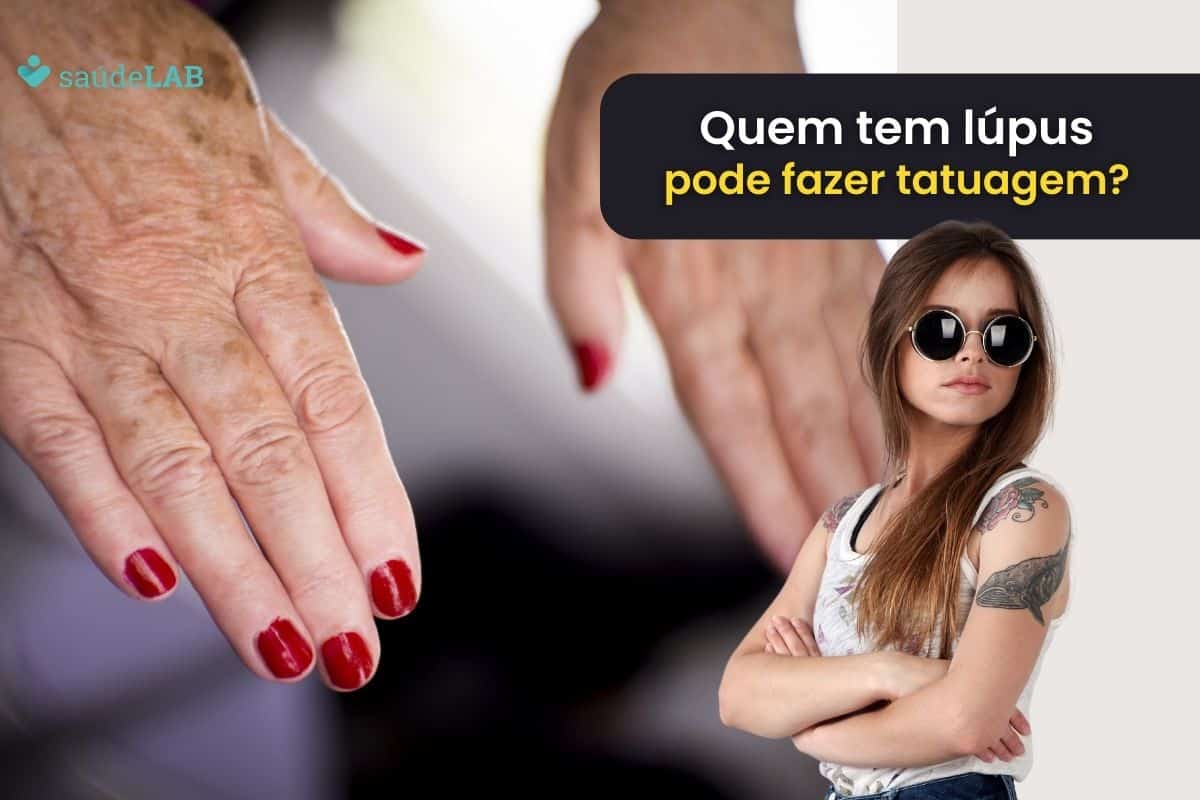 Quem tem lúpus pode fazer tatuagem? Entenda a condição de saúde 1 quem tem lúpus pode fazer tatuagem.