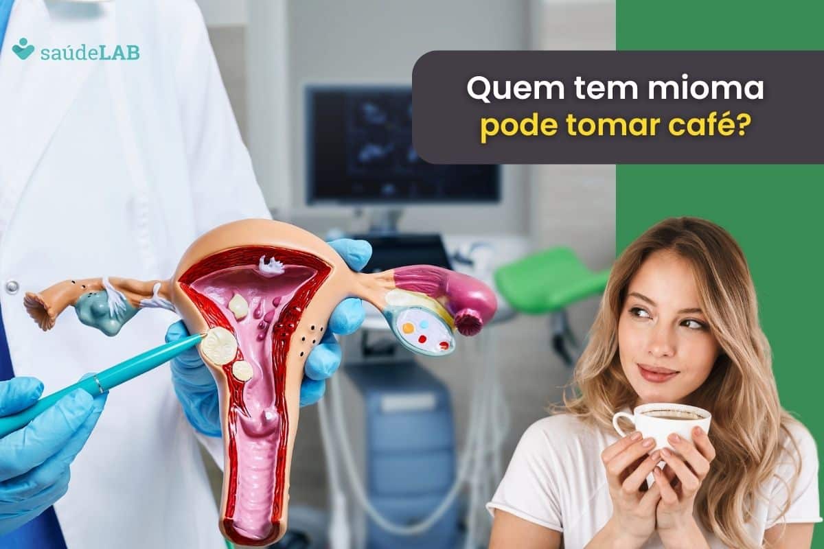 Quem tem mioma pode tomar café? Descubra como os alimentos podem interferir 1 quem tem mioma pode tomar café.