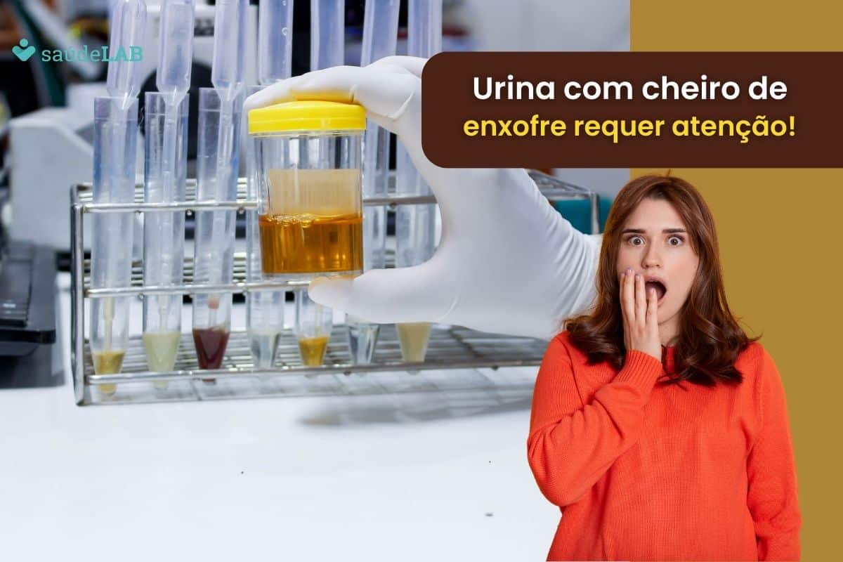 Urina com cheiro de enxofre: o que o sintoma pode ser? Será que é grave? Entenda 1 Urina com cheiro de enxofre.