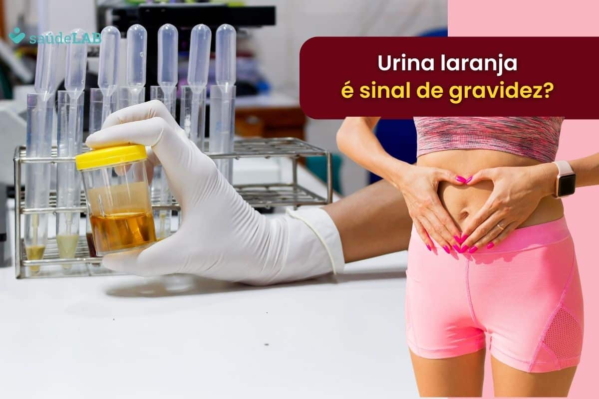 Urina laranja é sinal de gravidez? Ligue o alerta com esse sinal 1 urina laranja é sinal de gravidez.