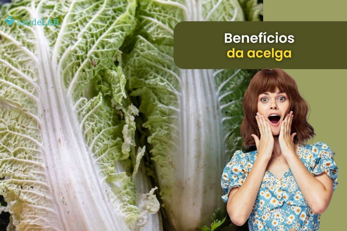 Acelga: uma verdura versátil e nutritiva para se ter sempre à mesa 1 Acelga.