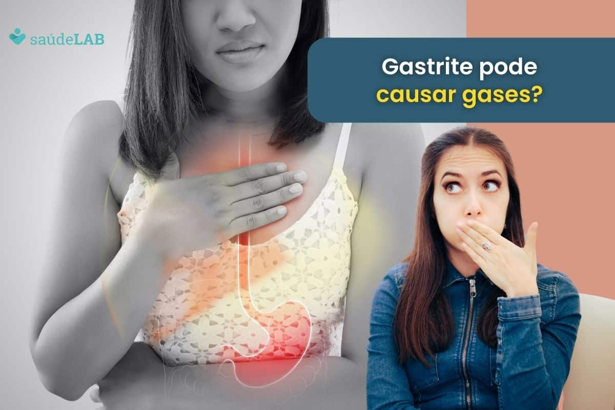 Gastrite causa gases? Entenda o sintoma e confira 6 dicas para melhorar 1 Gastrite causa gases.