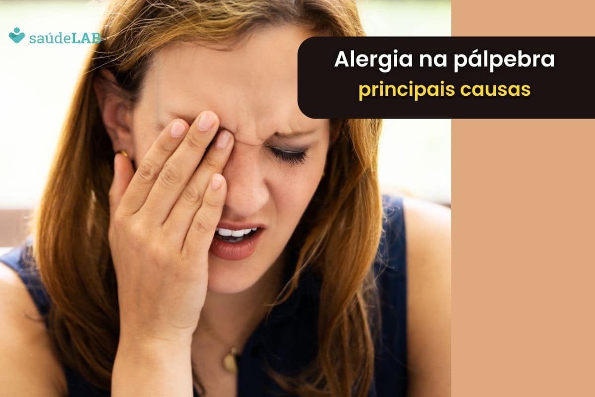 Alergia na pálpebra? Descubra agora as 8 causas mais comuns 1 Moça com sintomas de alergia na pálpebra.