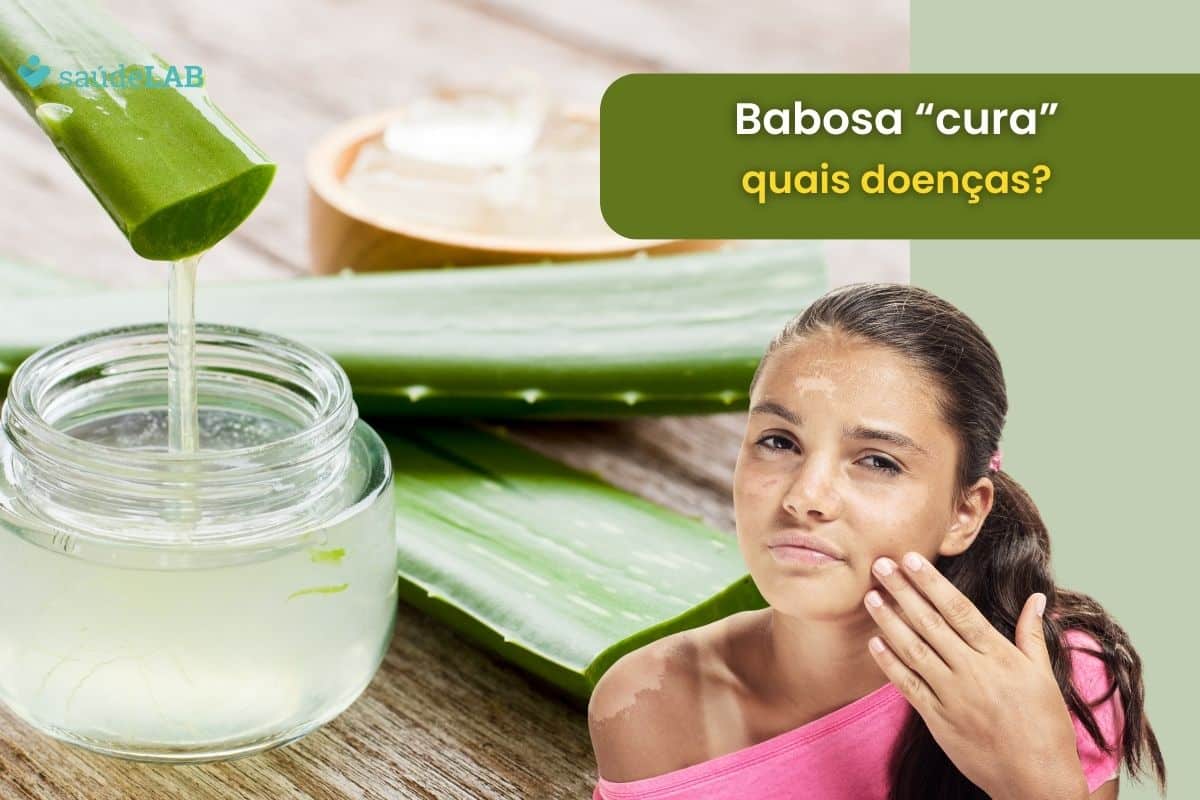 Babosa serve para que tipo de doença? Conheça agora todas as suas utilidades 1 babosa serve para que tipo de doença.