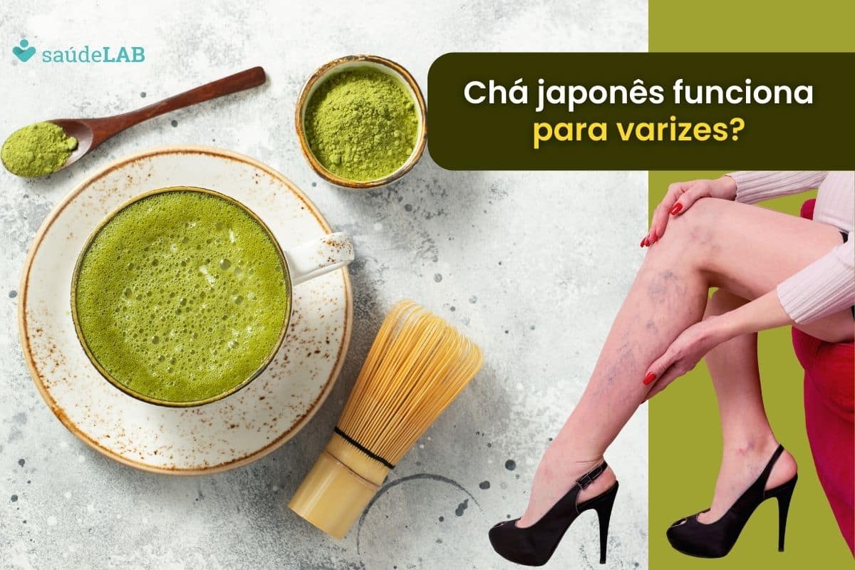 Chá japonês para varizes: saiba se ele realmente funciona para esta finalidade 1 chá japonês para varizes.