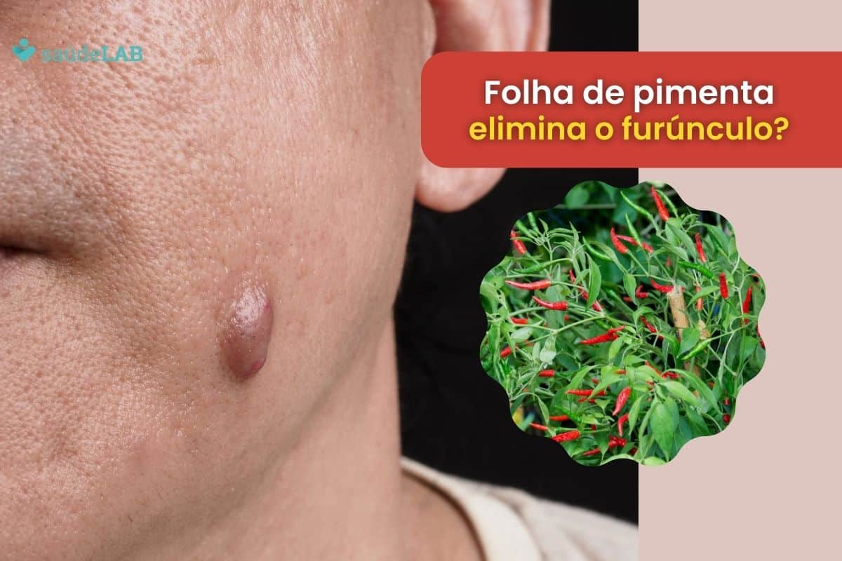 Folha de pimenta para furúnculo: estudo científico prova que a técnica funciona 1 folha de pimenta para furúnculo.