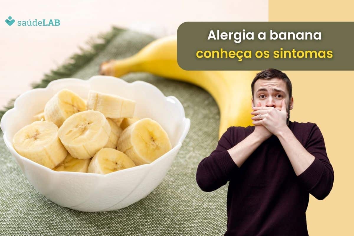 Sintomas da alergia a banana: 9 sinais de que você deve ligar o alerta 1 sintomas da alergia a banana.