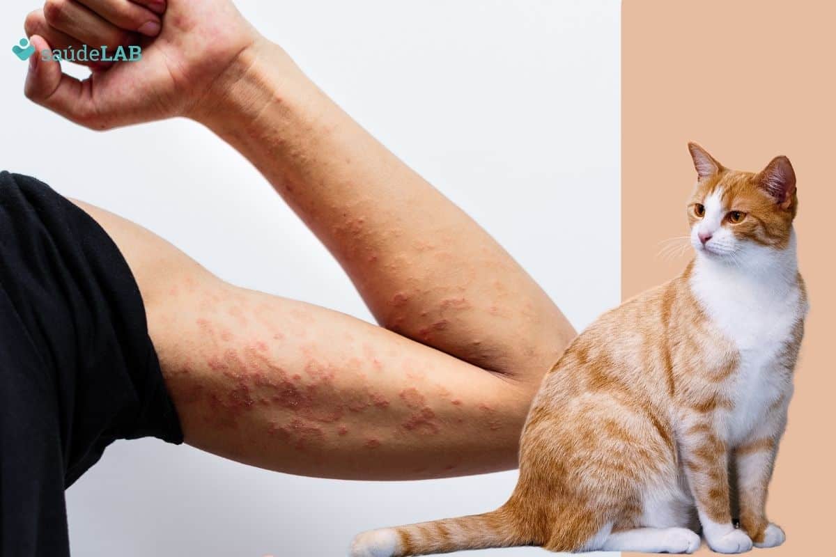 Surto de Esporotricose: o que é a doença transmitida por gatos que está fora de controle 1 esporotricose.
