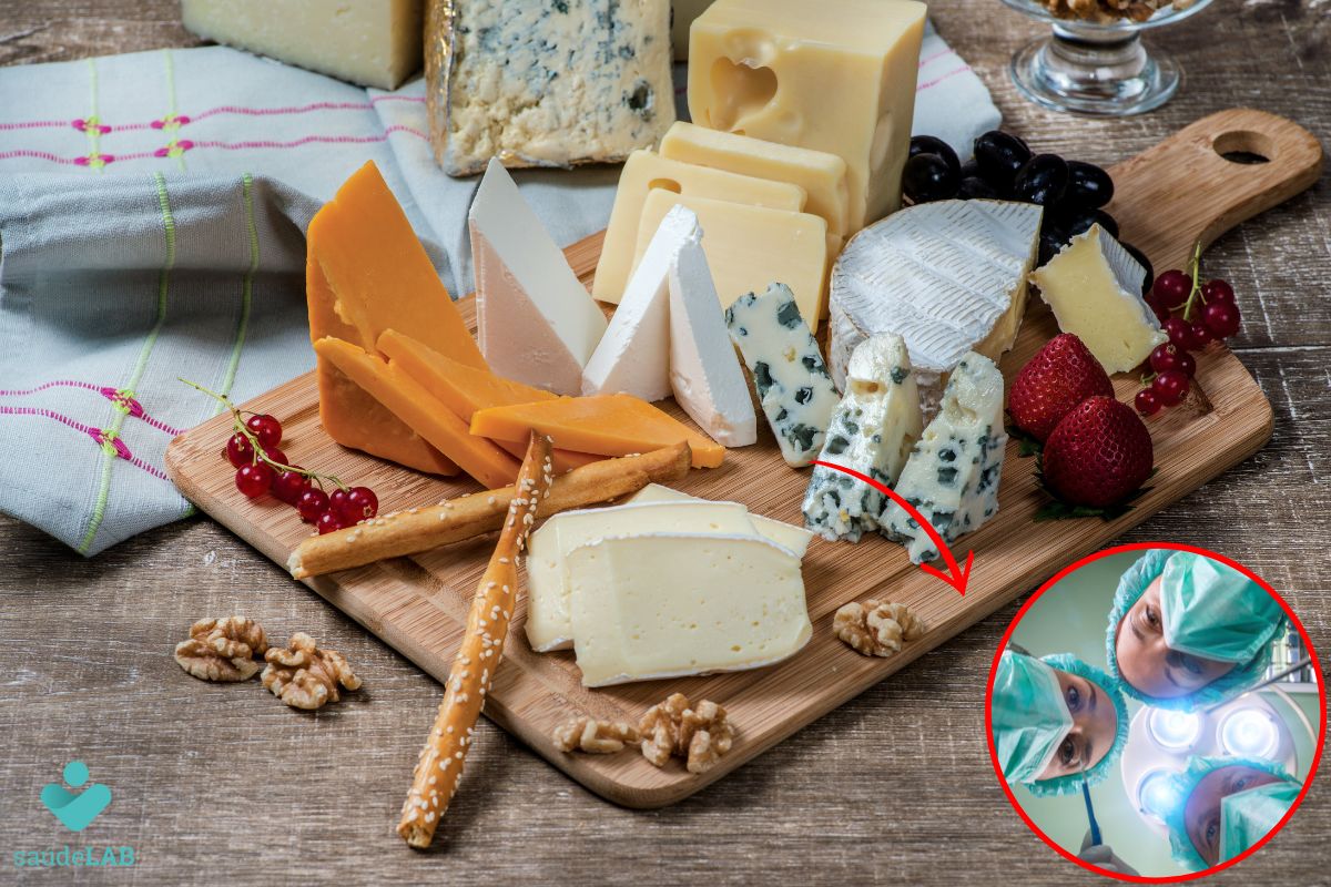 Queijo é remoso? Confira agora seus efeitos na cicatrização 1 Queijo é remoso.
