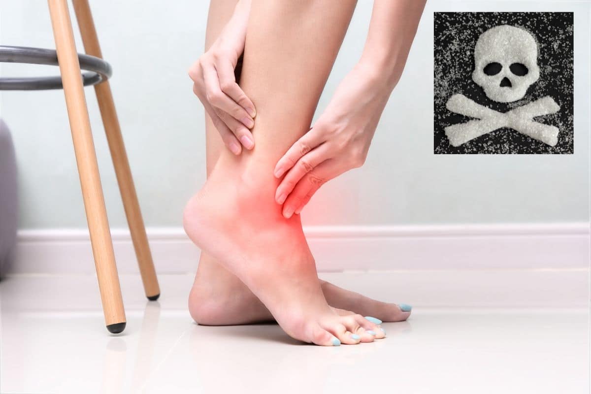 Neuropatia Diabética: causas, sintomas e tratamentos efetivos 1 Neuropatia diabética.