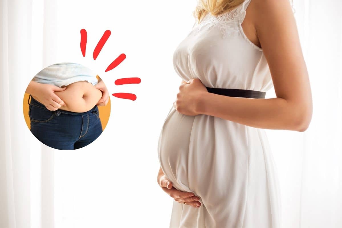 Diástase abdominal: o que é, sintomas e como tratar 1 diástase abdominal.