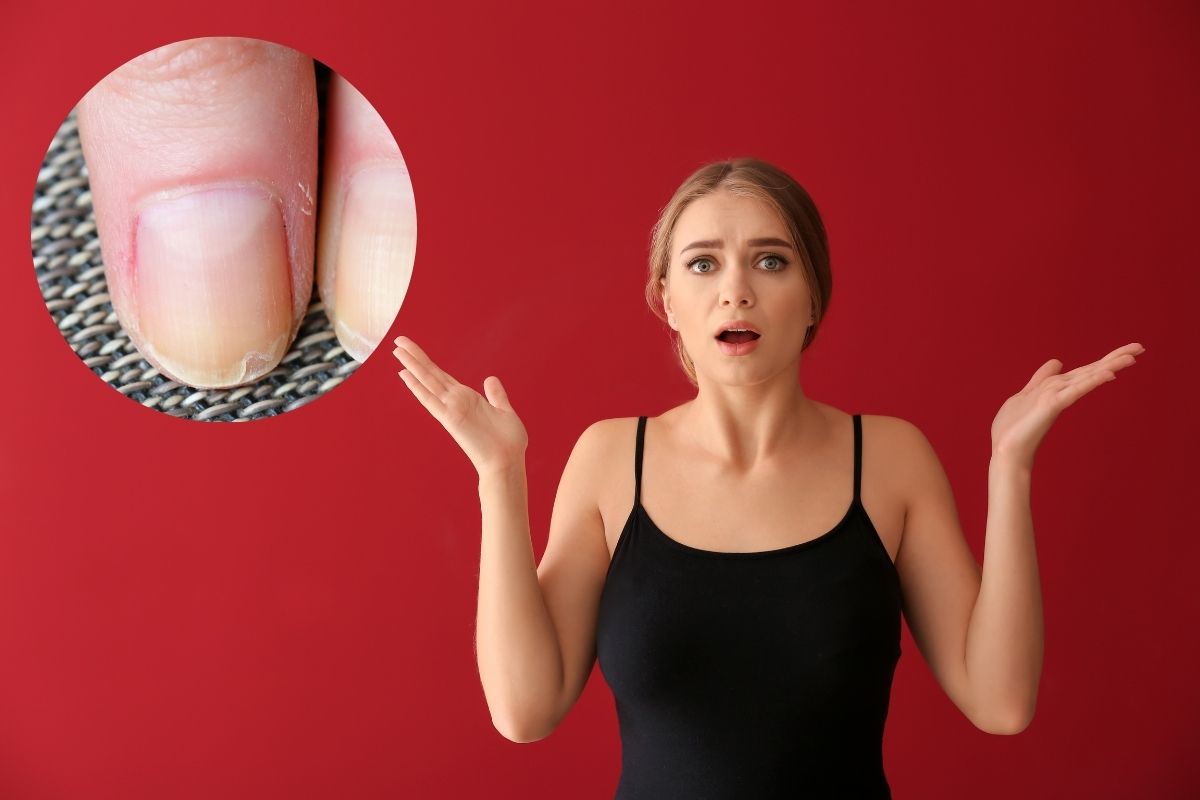 Unhas onduladas: causas, prevenção e tratamentos para mantê-las saudáveis 1 Unhas onduladas.