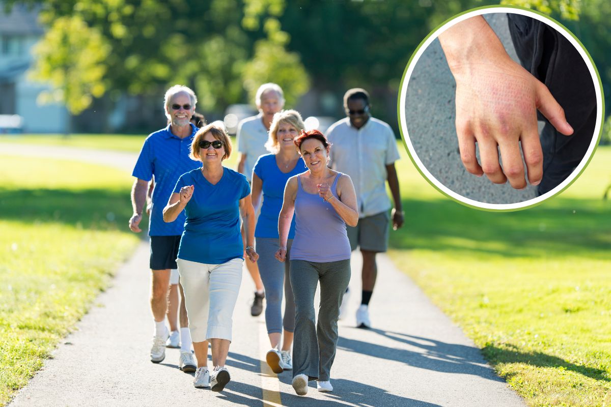 É normal ficar com as mãos inchadas ao caminhar? Saiba o que pode ser 1 Mãos inchadas ao caminhar.