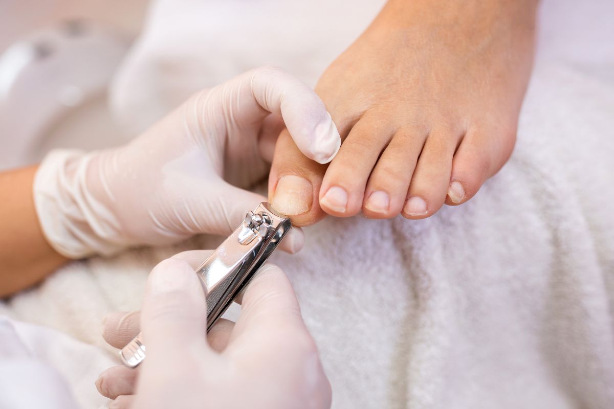 8 tipos de doenças das unhas: o que elas podem estar tentando te dizer sobre sua saúde 1 8 tipos de doenças das unhas.