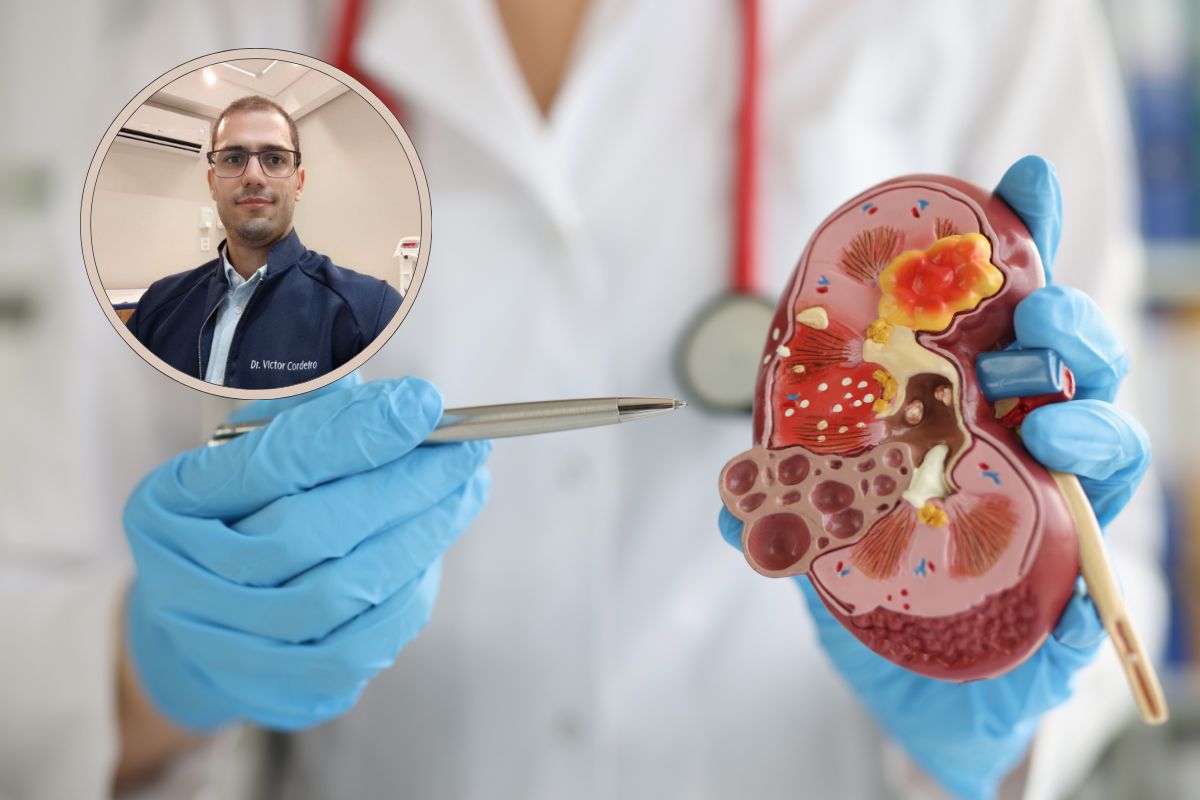 Tumor no rim é grave? O que você precisa saber sobre o câncer renal 1 Tumor no rim é grave.