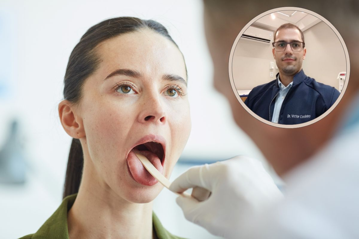 Câncer de boca: o que você precisa saber sobre prevenção, sintomas e tratamento 1 Câncer de boca.