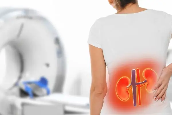 Óleo de copaíba faz mal para os rins? Entenda os riscos, benefícios e como usar com segurança 2 Pessoa com problema renal realizando exames.