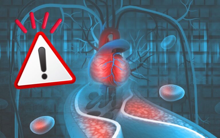 Nova diretriz de colesterol: veja o que muda na prevenção de infarto e AVC 1 Nova diretriz de colesterol.